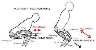 Knee-Sheer